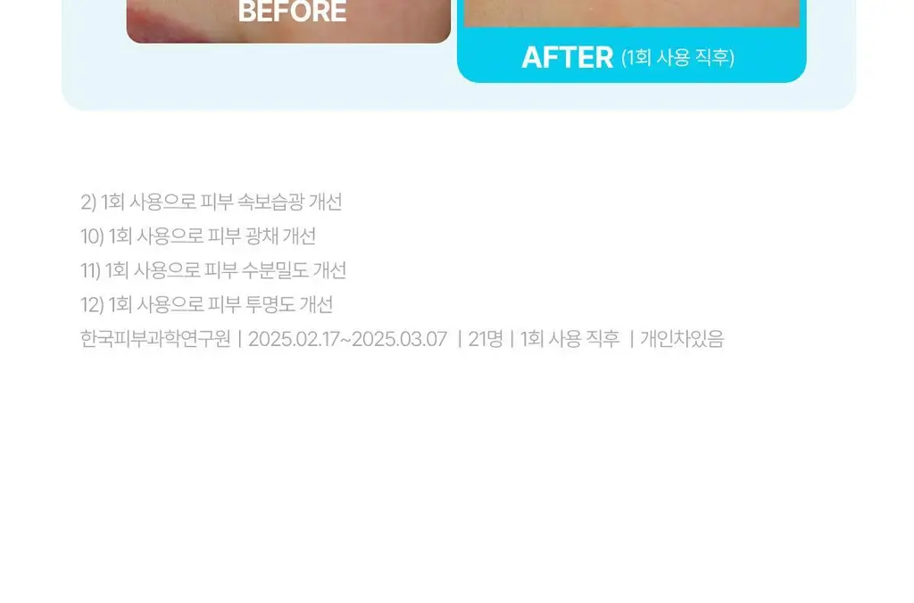 [청담샵템] 센텔리안24 마데카랩 겔 마스크 5매(히알 워터풀 수분/PDRN 스킨 탄력) 상세페이지 24